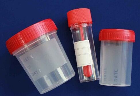 examination jars for parasites