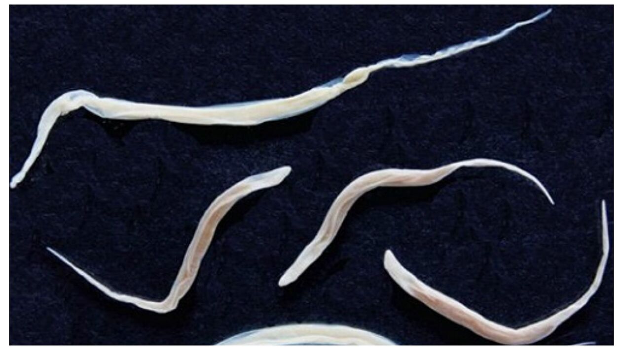 Pinworms are common parasites belonging to the helminth group.