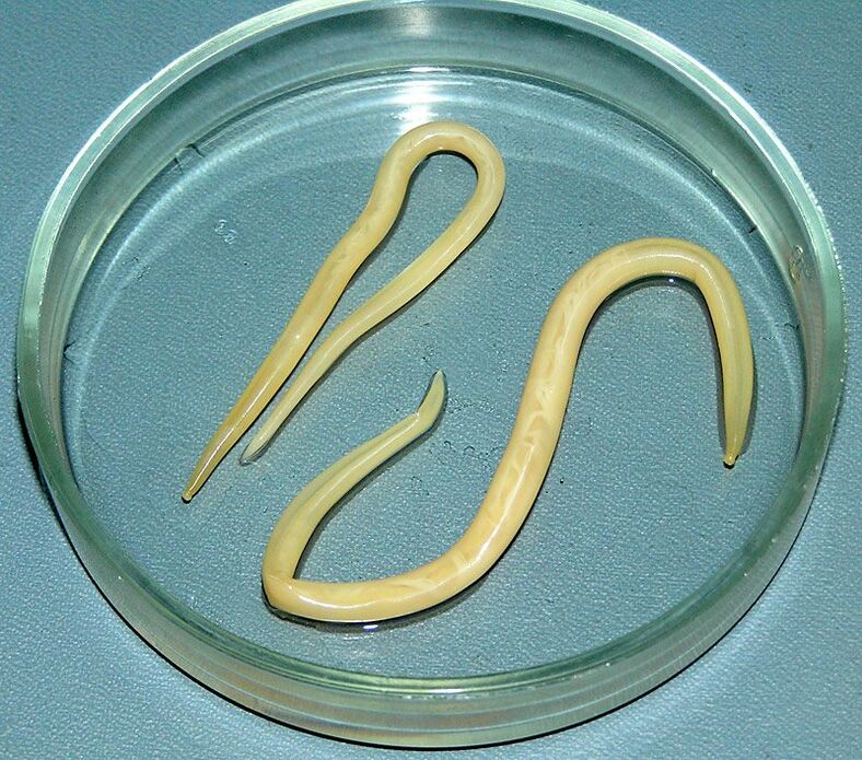 Roundworms that attack a person's digestive system, lungs and heart