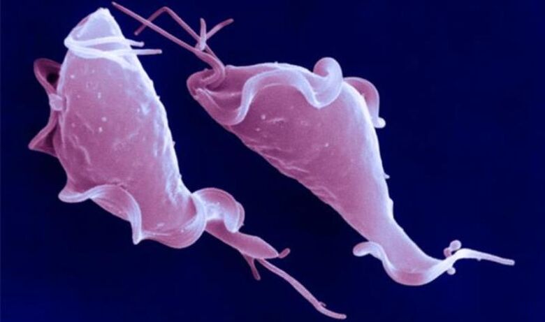 Trichomonas vaginalis is a protozoan parasite that causes infertility.